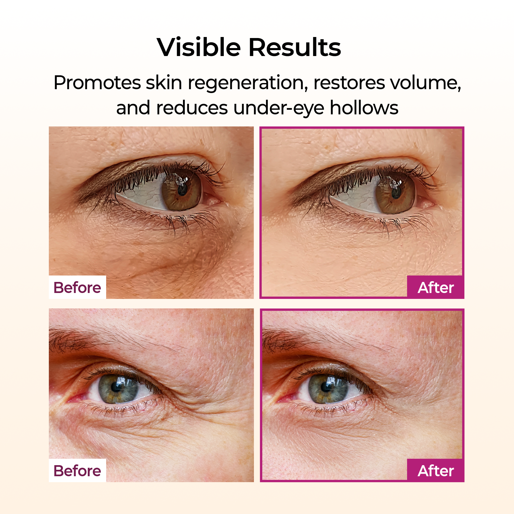 Pigmentation Duo — Picotonic + Multi Balm detail view 5 — Melax K-Beauty