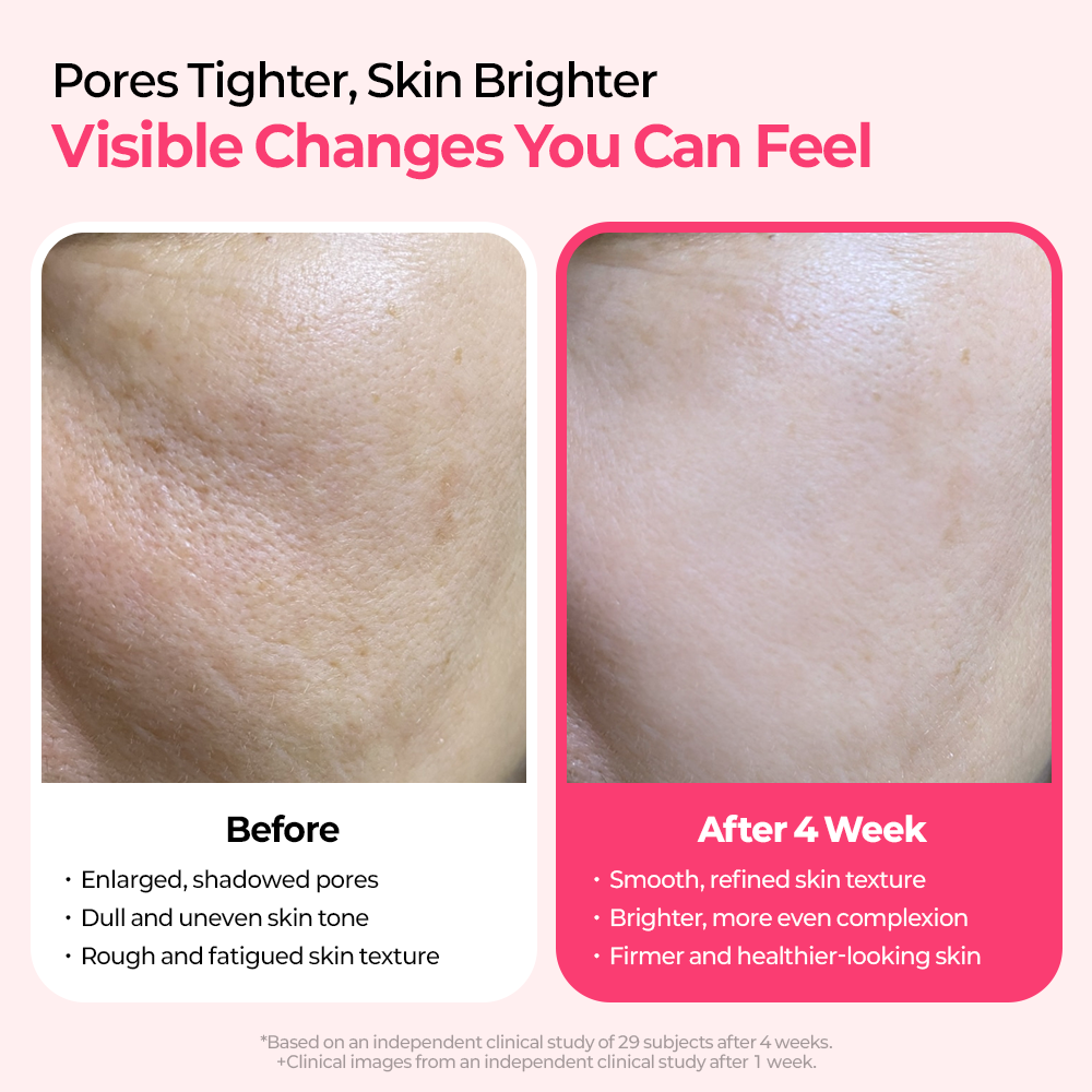 Cemenrete Cyano Pink Spicule line detail view 7 — Melax K-Beauty