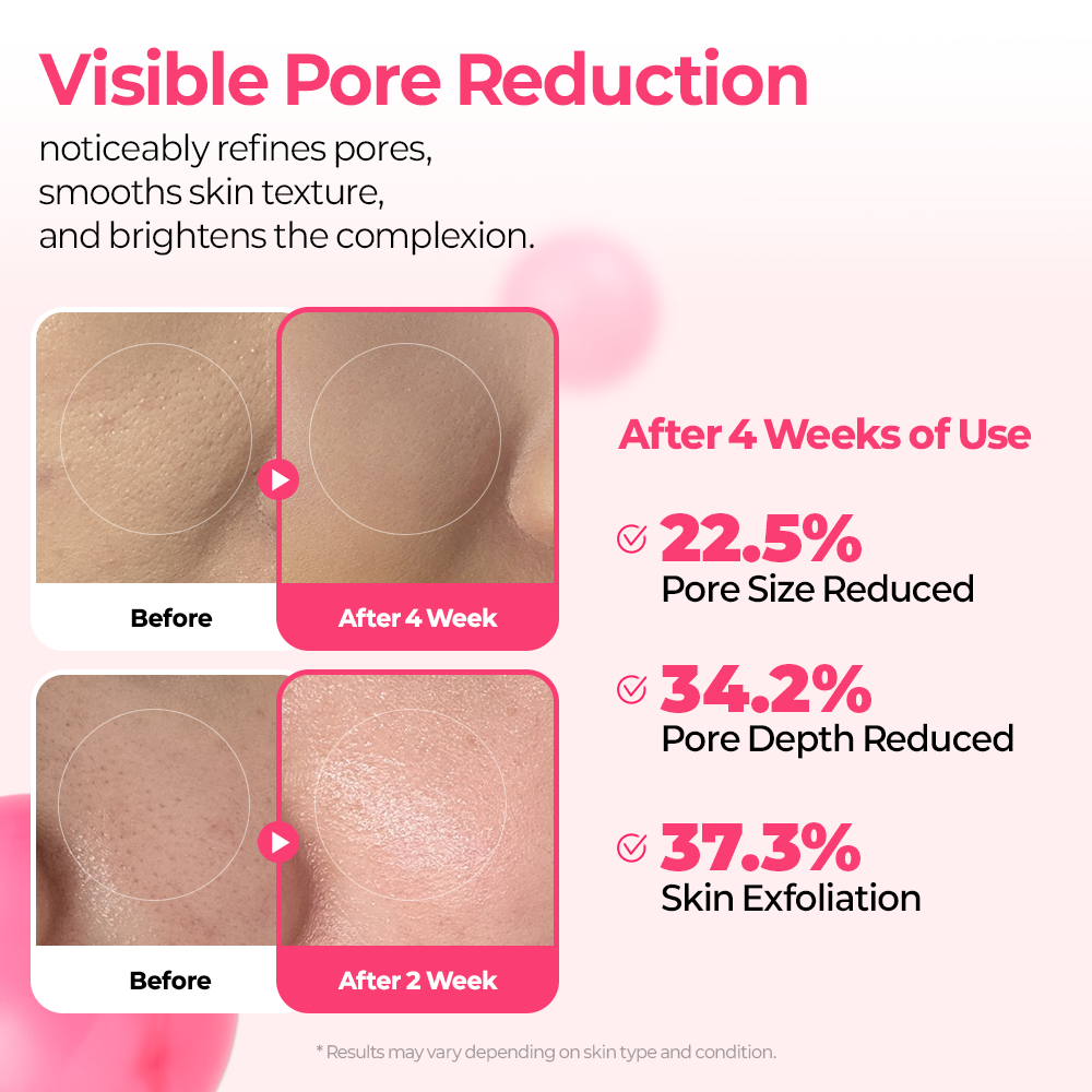 Cemenrete Cyano Pink Spicule line detail view 3 — Melax K-Beauty