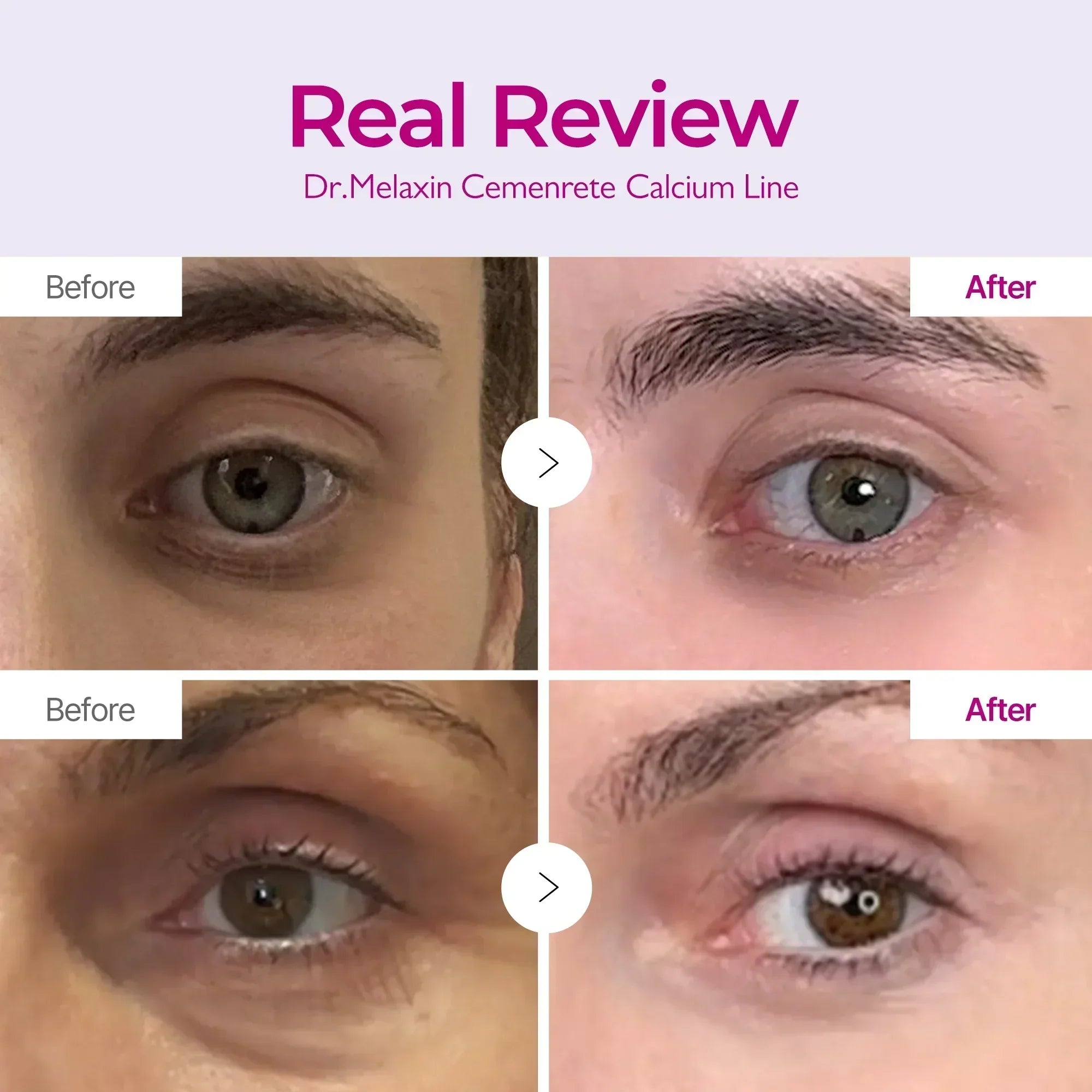 Calcium Skincare Bundle detail view 3 — Melax K-Beauty