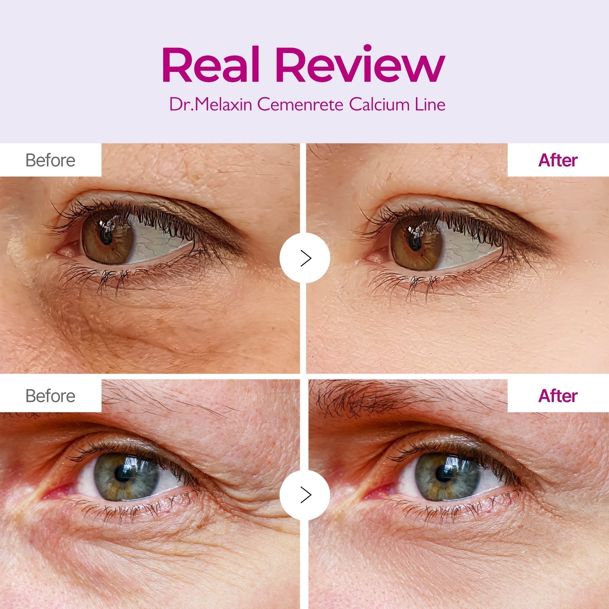 Melax Complete 7-Step Routine detail view 5 — Melax K-Beauty