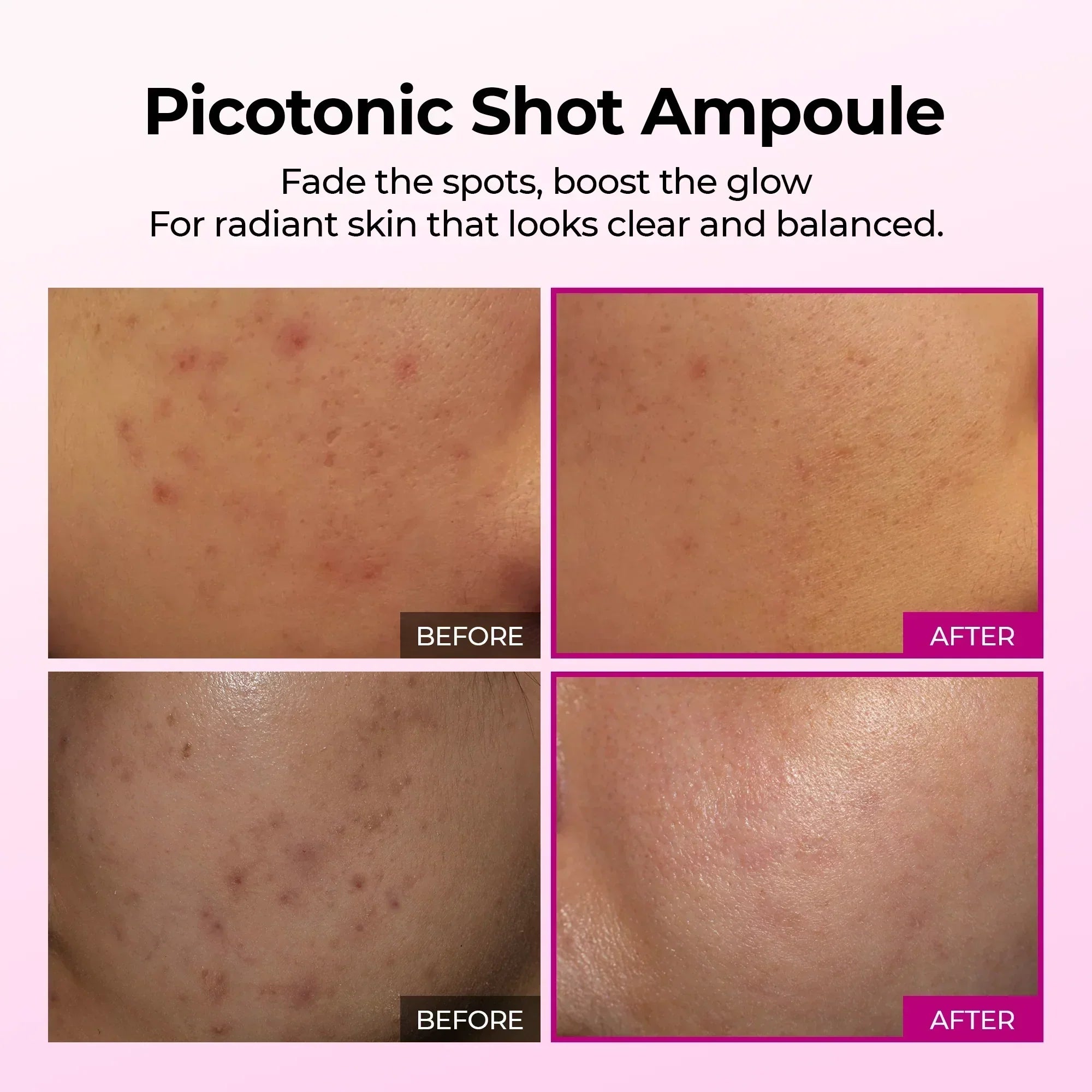 Pigmentation Duo — Picotonic + Multi Balm alternate angle — Melax K-Beauty