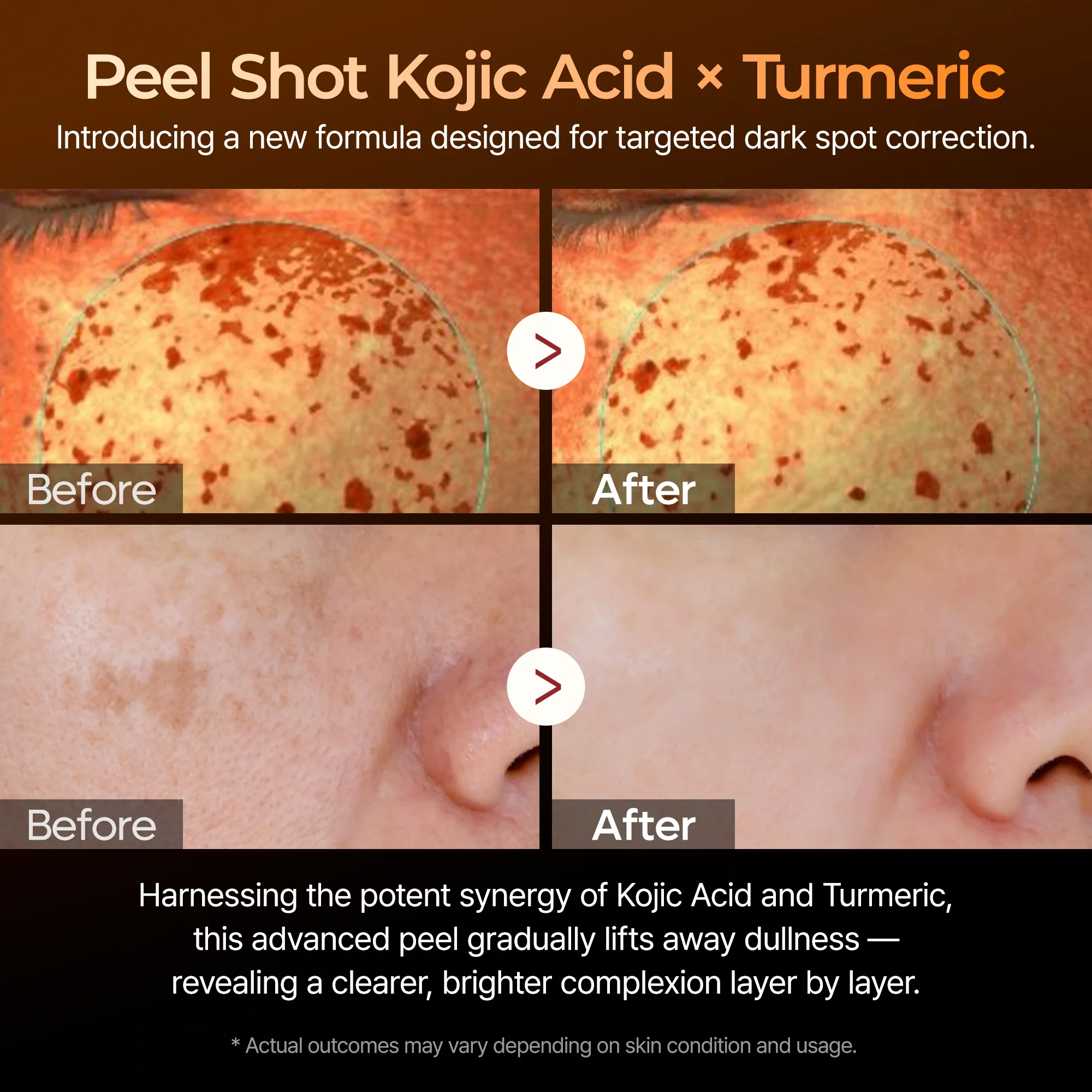 Peel Shot kojic Acid Turmeric Serum detail view 3 — Melax K-Beauty
