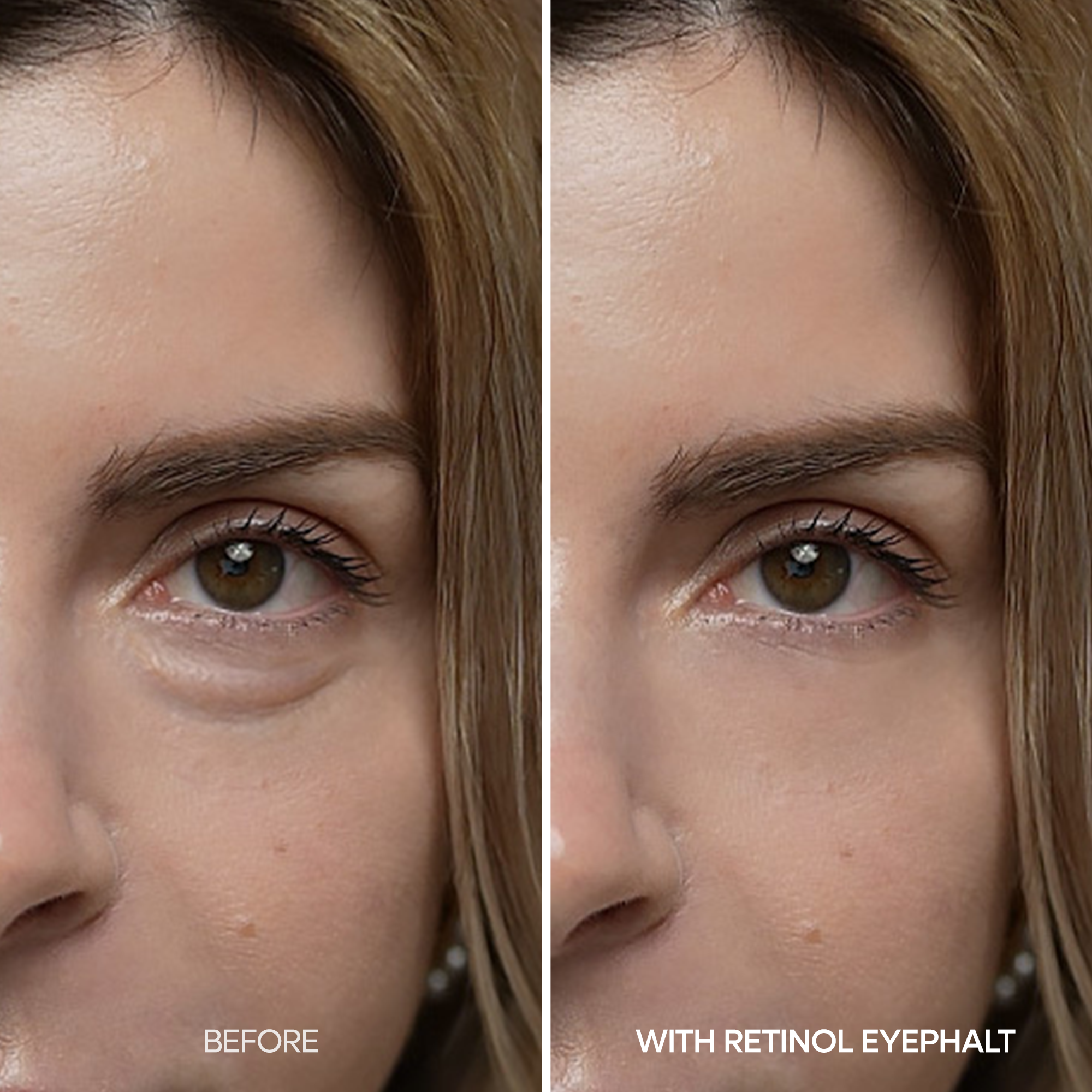 [FLASH 1+1 DEAL] Retinol Eyebag Cream detail view 4 — Melax K-Beauty