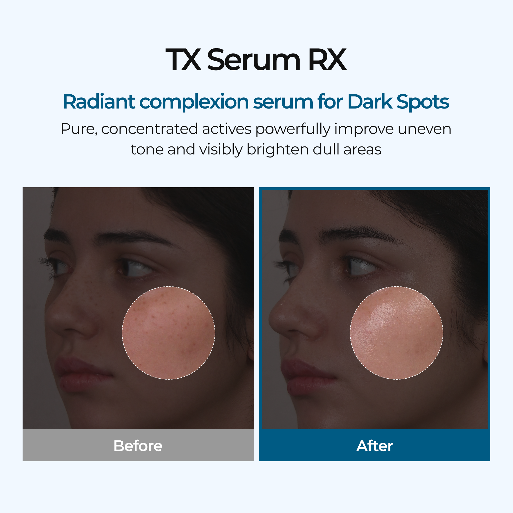TX Ampoule Rx alternate angle — Melax K-Beauty