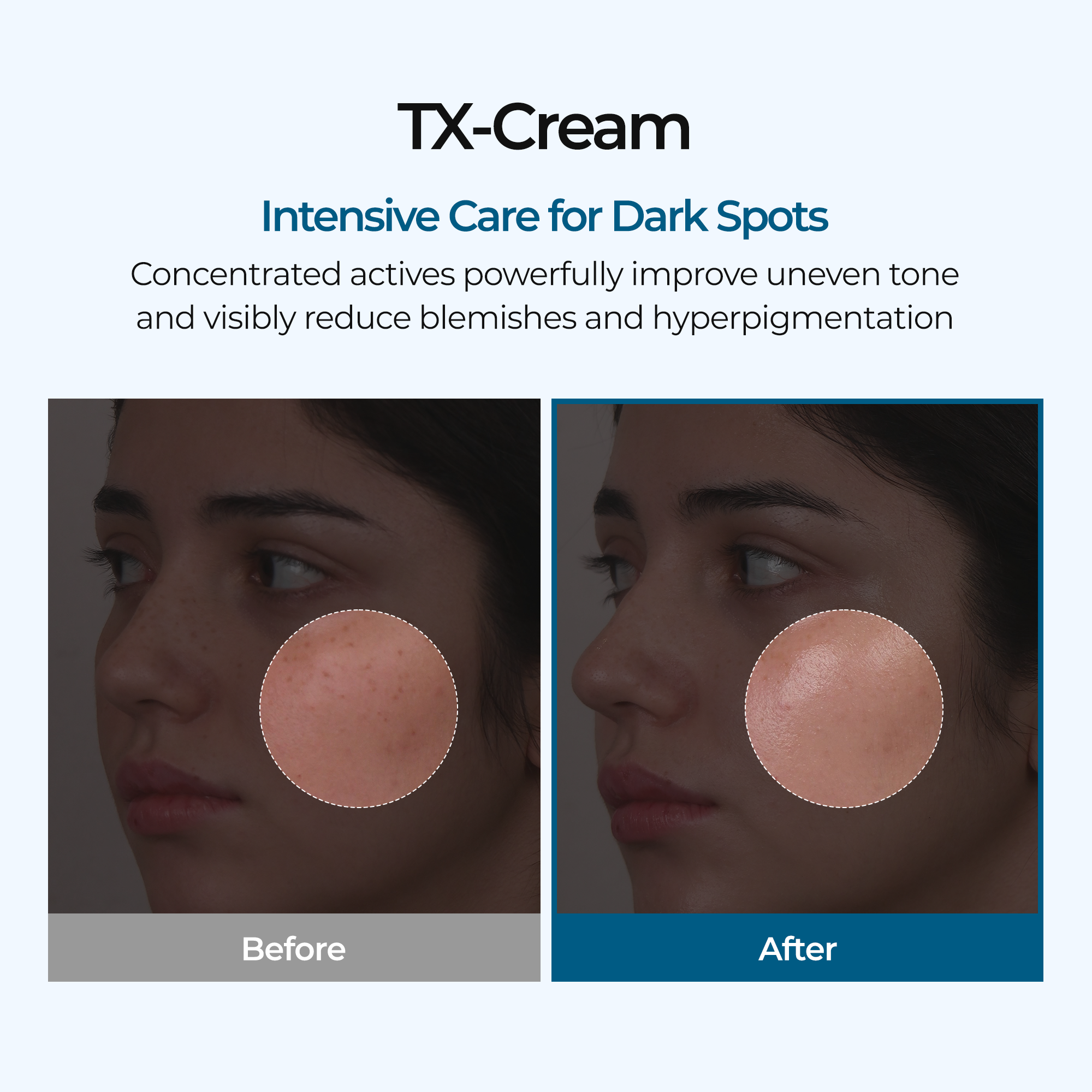 TX Cream detail view 4 — Melax K-Beauty