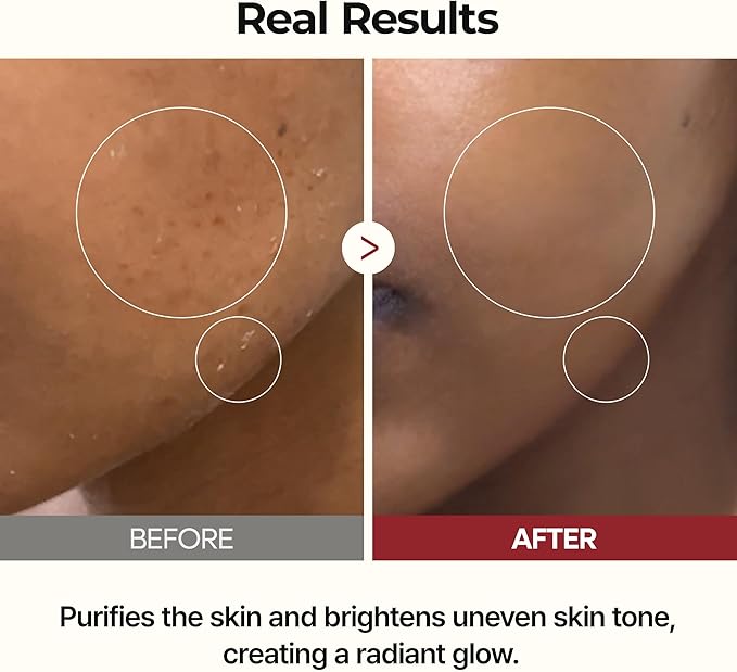 Melax Complete 7-Step Routine detail view 4 — Melax K-Beauty