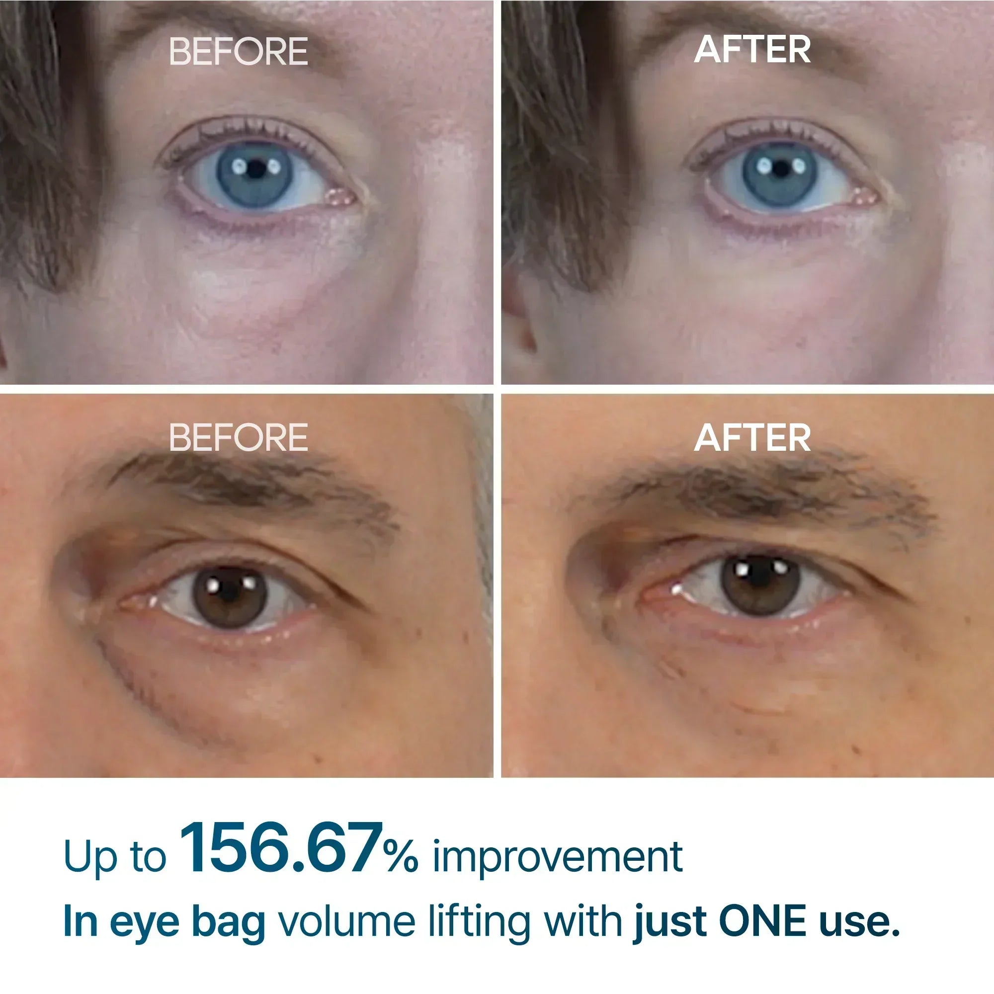 Melax Eye Care Complete Routine alternate angle — Melax K-Beauty