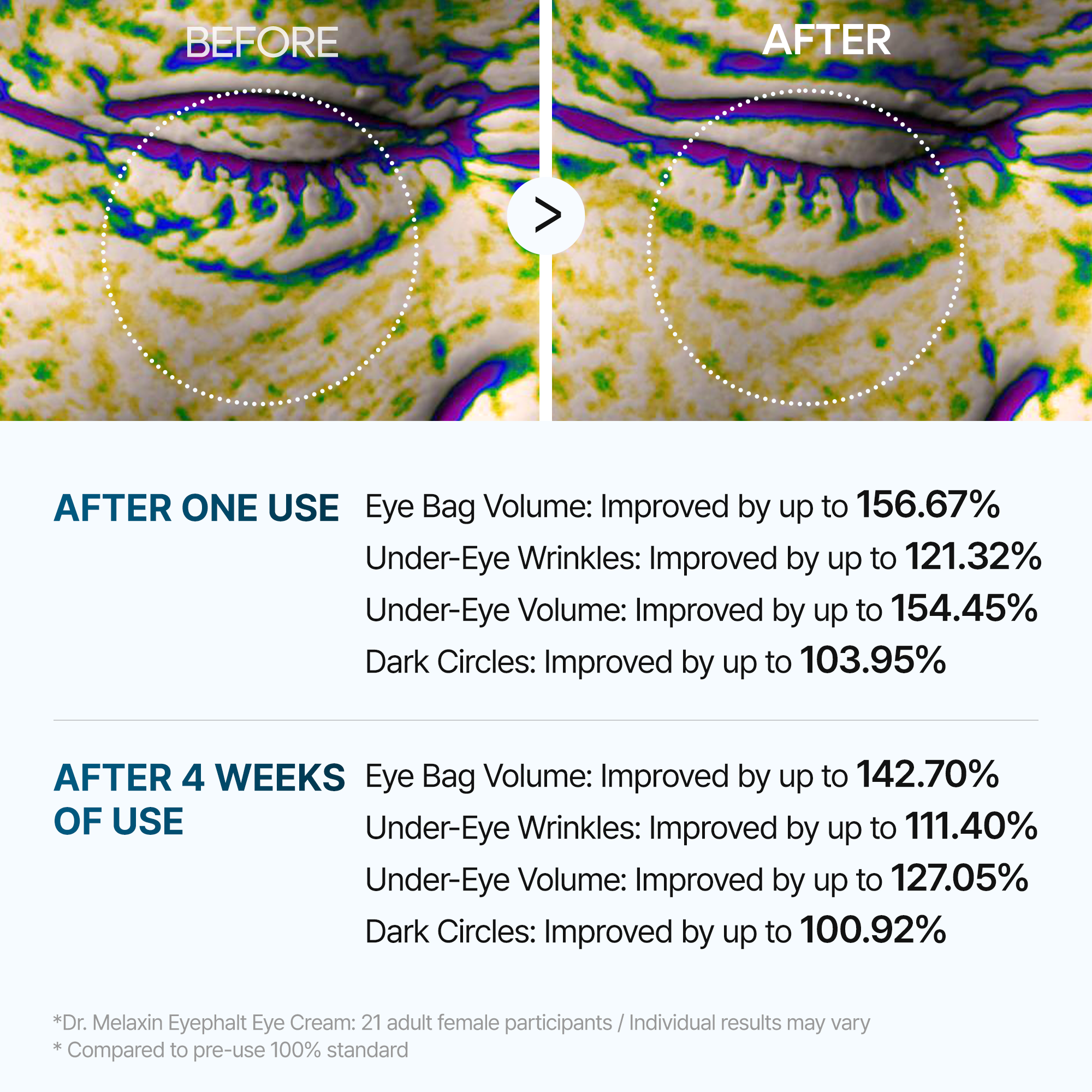 [SPECIAL 1+1 DEAL] Eyephalt eyebag cream detail view 5 — Melax K-Beauty