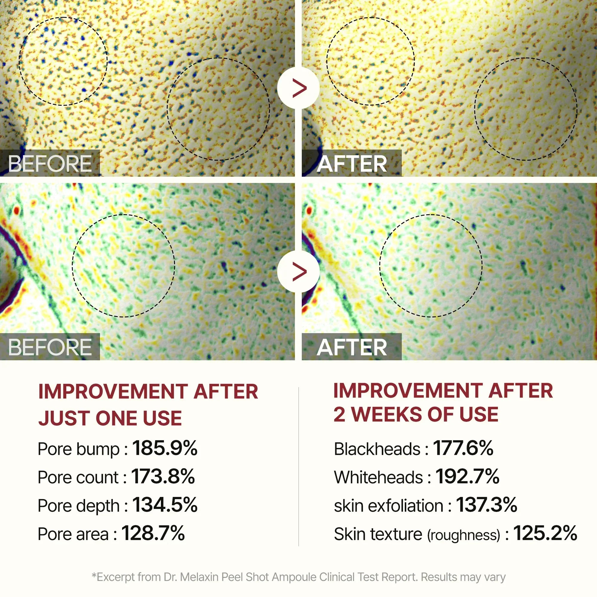 Peel Shot Glow Rice Line detail view 11 — Melax K-Beauty