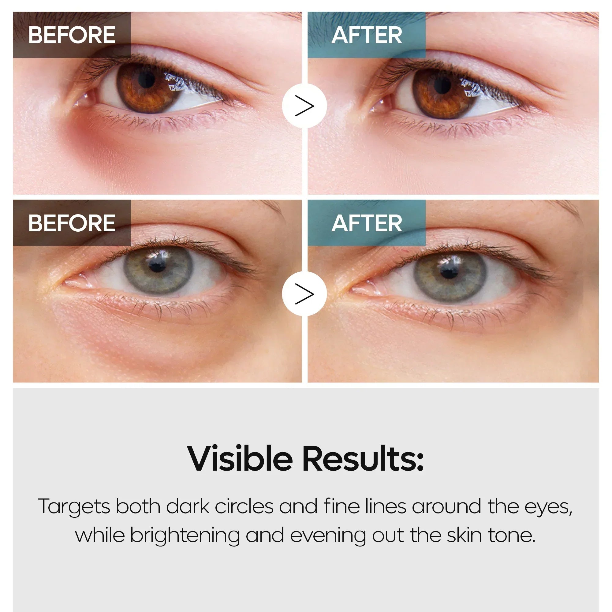 TX Retinalsome Double Effect Eyecream detail view 4 — Melax K-Beauty