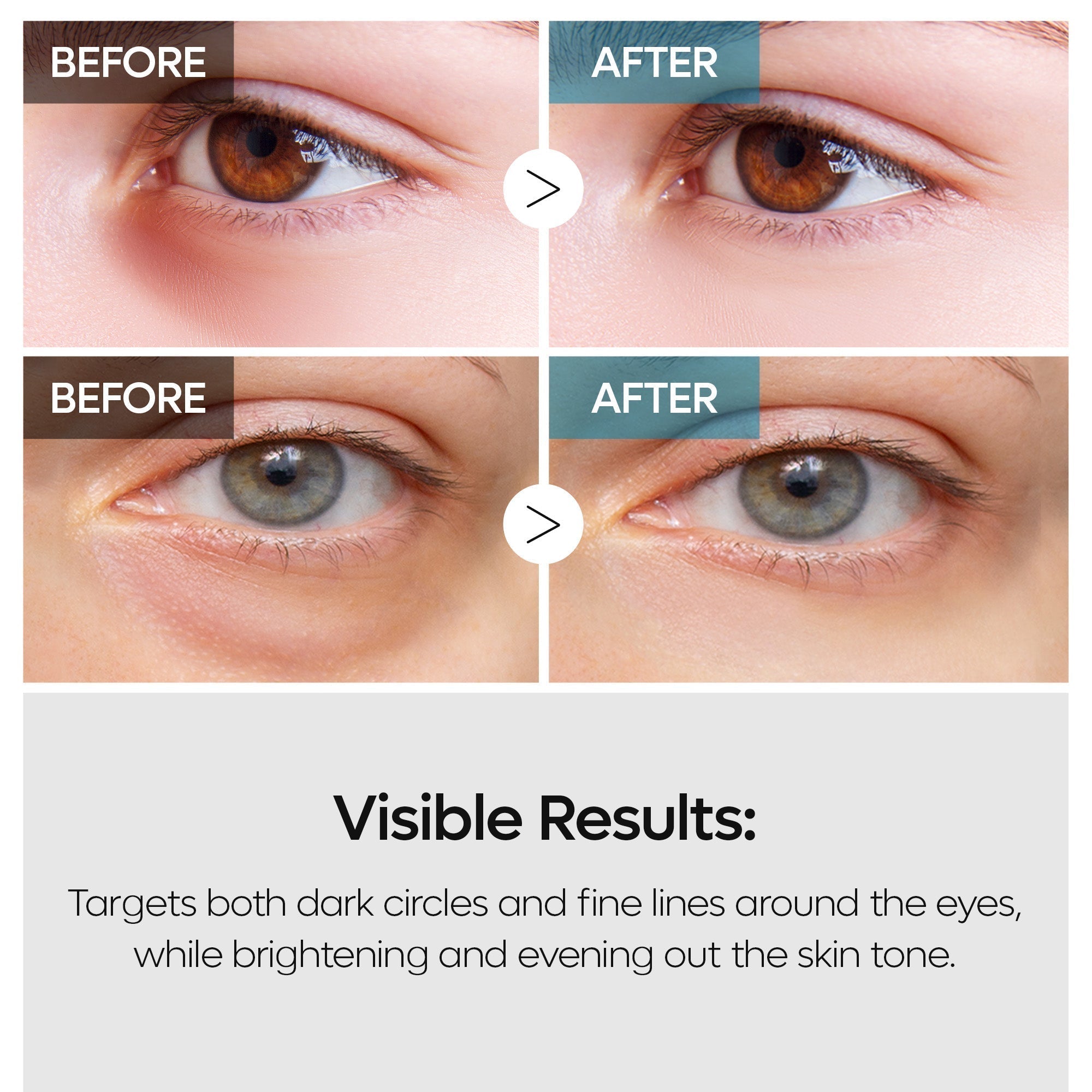 TX Eye Care Duo detail view 5 — Melax K-Beauty