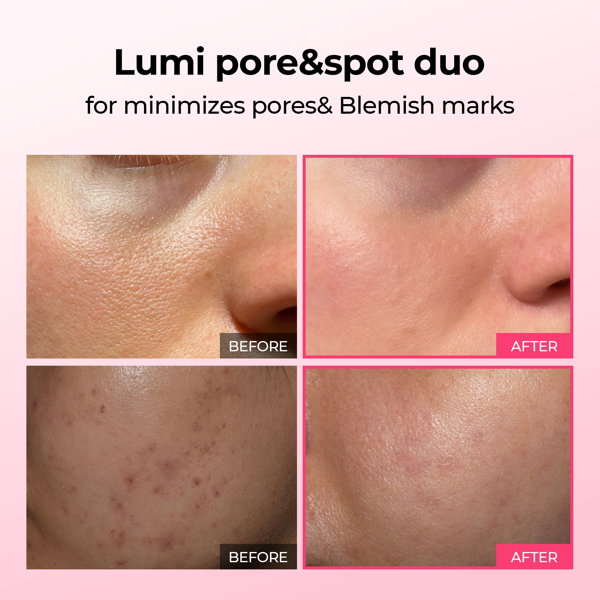 Lumi Pore & Spot Care Duo alternate angle — Melax K-Beauty