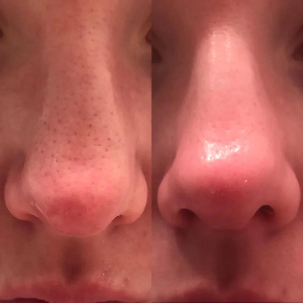 Glass Skin Essential Kit (5 pcs) detail view 6 — Melax K-Beauty